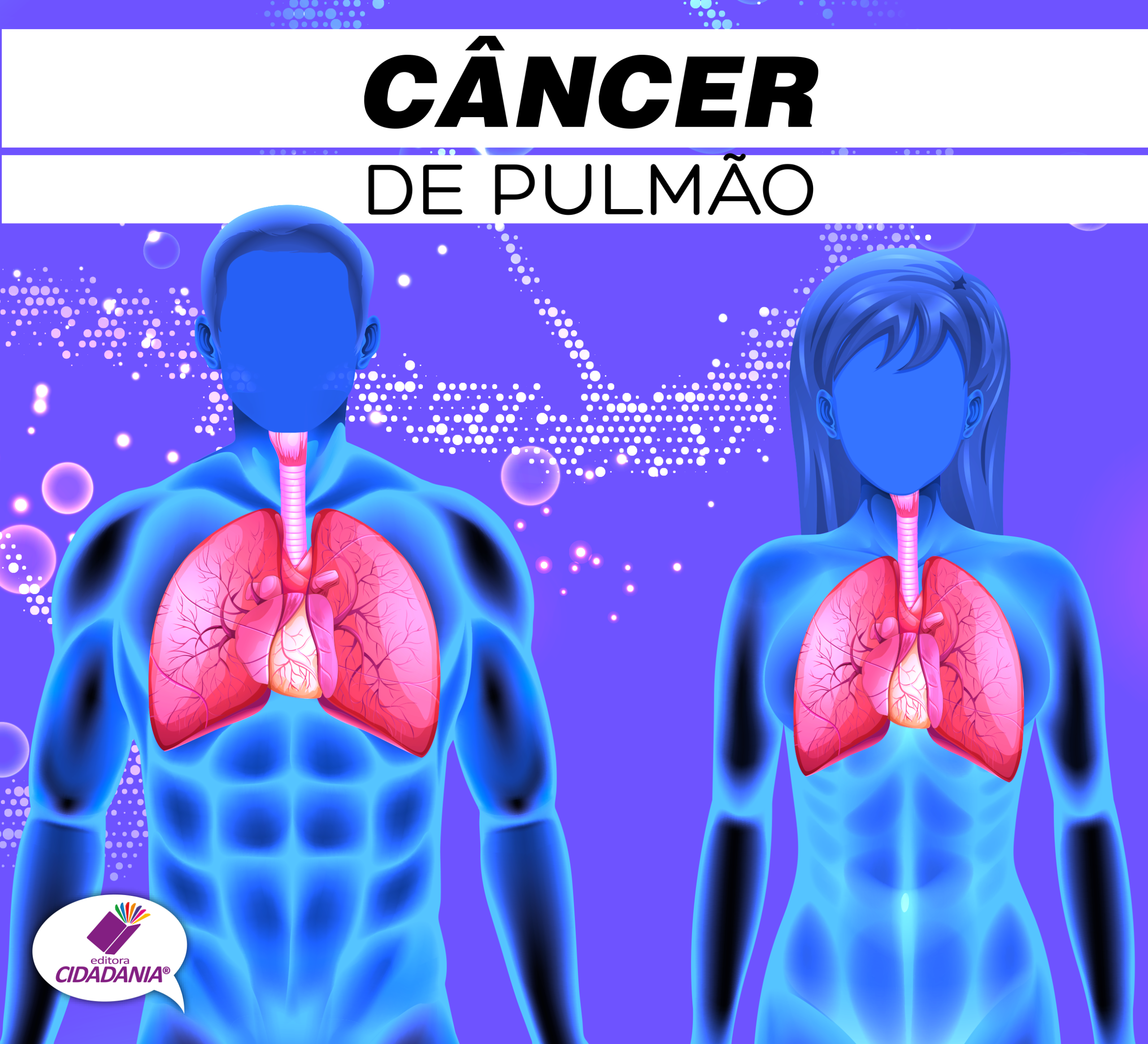 cancer-de-pulmao-1.png