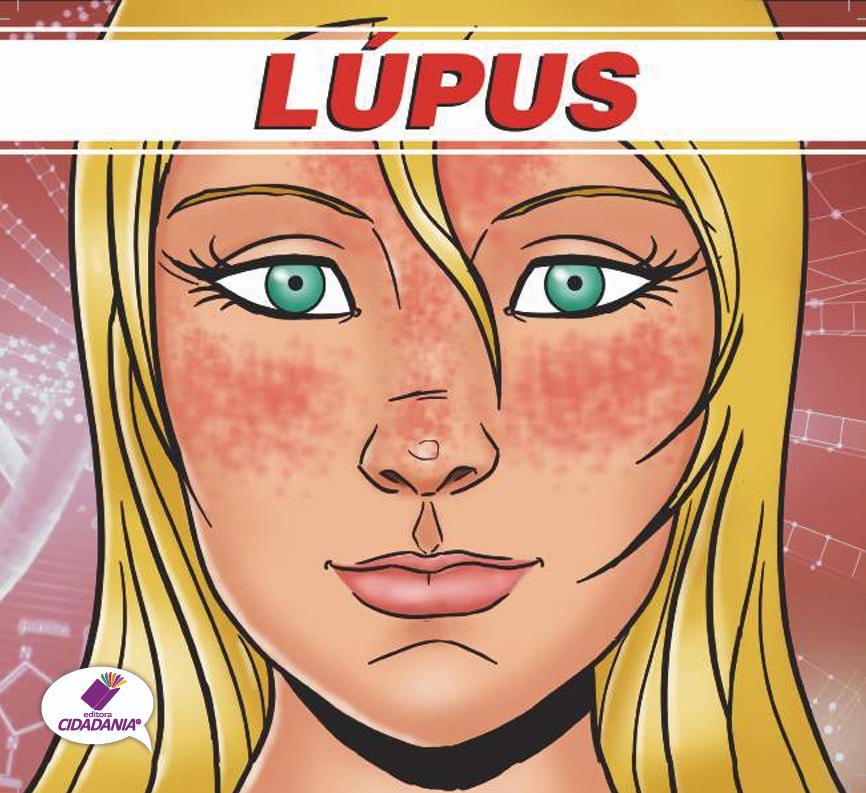 lupus-1.jpeg